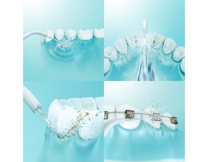 Irrigatore Orale Senza Fili, Pulitore Interdentale Elettrico, Piccolo Con 5 Accessori E 5 Modalità Di Pulizia, Pulitore Dentale, Irrigatore Orale, IPX7, Impermeabile, Ricarica USB, 300 Ml - Foto 8